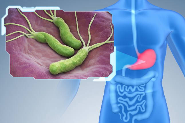 Хеликобактер пилори (Helicobacter pylori): когда требуется обследование и лечение